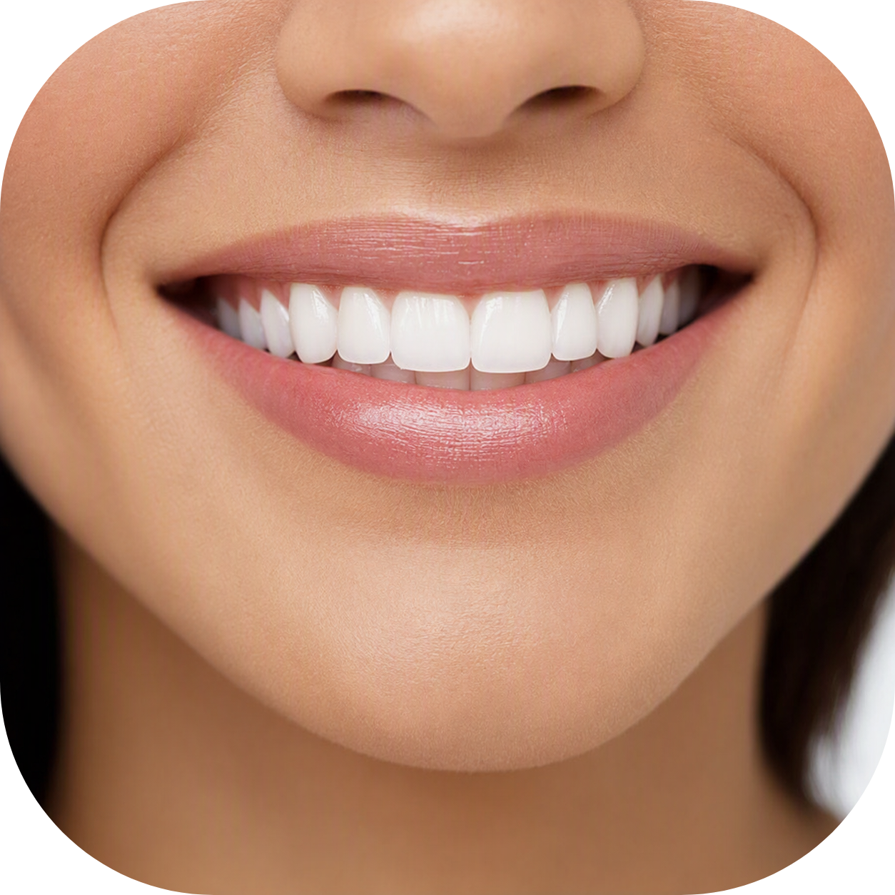 Oralcare